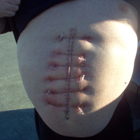 mexican surgery... my poor friend!!