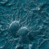 Bacterial cells of Staphylococcus aureus