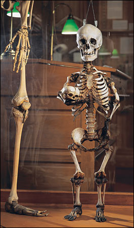 Dwarf skeleton with her baby's skull