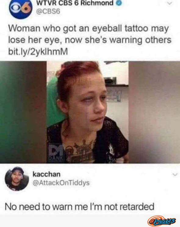 Retard