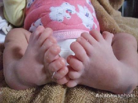 baby with more toes than you 
