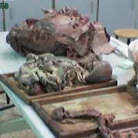 real human parts , cadavers in an anatomylab ...this is what med sudent do 4 fun