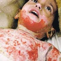 During Easter, Pray for the Innocent Victims of War
