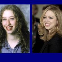 improvement with age or plastic surgery?