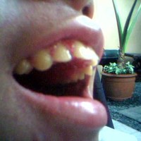 Closeup Smile