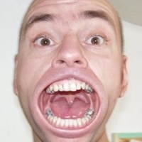 Me and my English fillings my name is MarkPreston from Hull