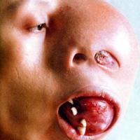 Pro-Choice?