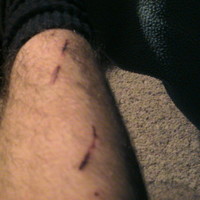 wounded knee