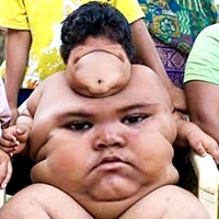 Gut Face