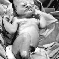 This child was born in Iraq in the years since the Gulf War