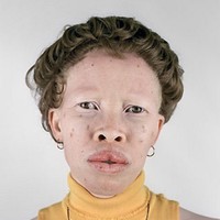 No lip implants needed