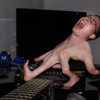 .................