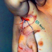 tickle tickle